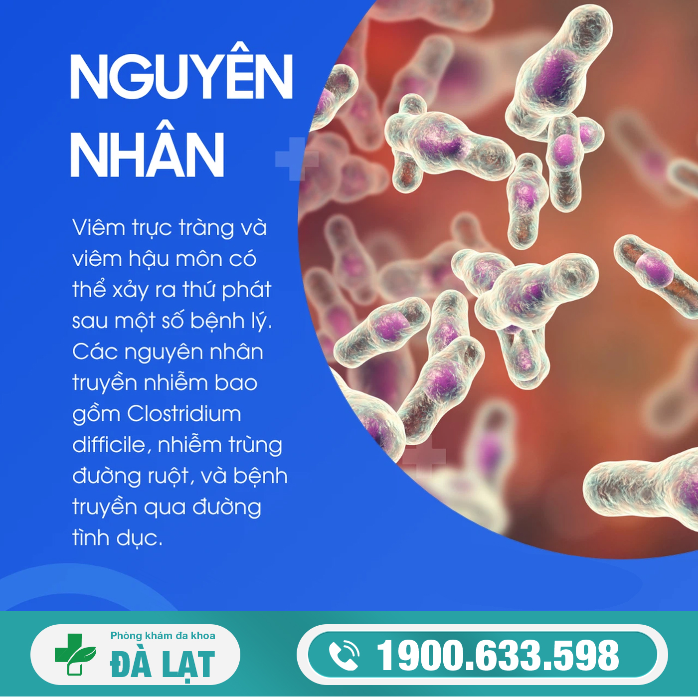 Hình ảnh minh họa
